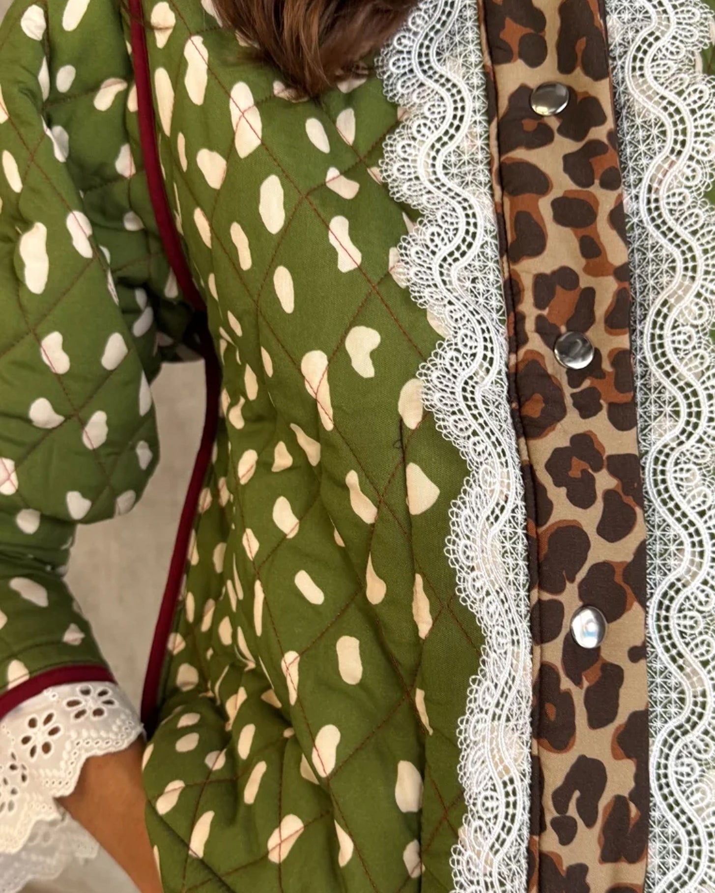 Pink Dallas Reversible Jacket - Multi